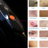 Beauty Monster Plasmapen Fibroblast Wrinkle Eyelid Lift Plasma Pen Spot Tattoo Freckle Mole Removal Pen
