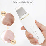 Ultrasonic Skin Scrubber Deep Face Cleaning Machine Peeling Shovel Facial Pore Cleaner Face Skin Scrubber Lift  Beauty Machine